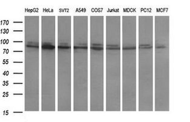 DNM1L Antibody in Western Blot (WB)