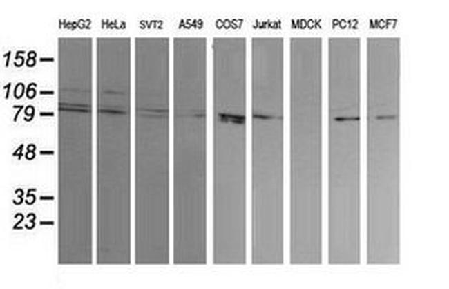 DNM1L Antibody in Western Blot (WB)