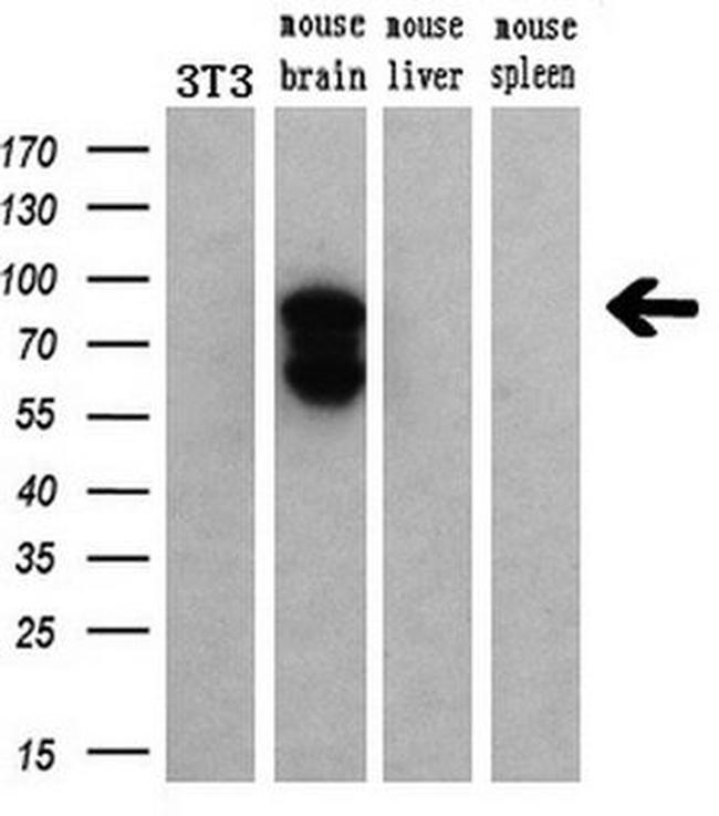 DNM1L Antibody in Western Blot (WB)