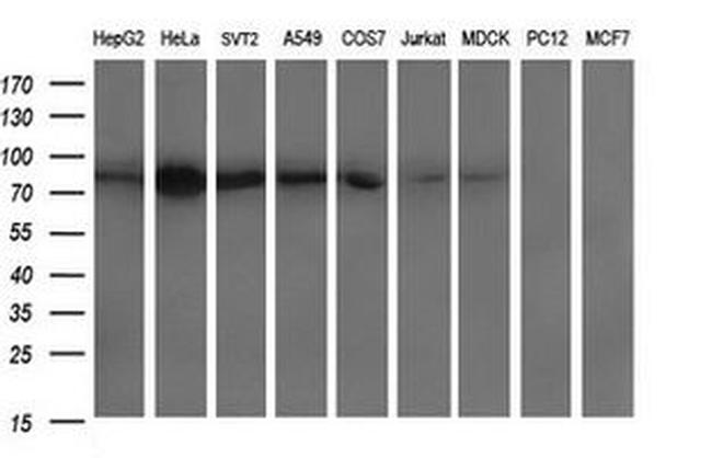 DNM1L Antibody in Western Blot (WB)