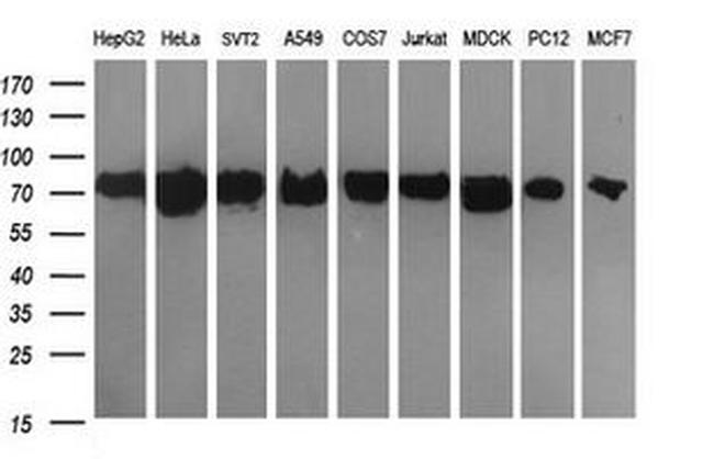 DNM1L Antibody in Western Blot (WB)