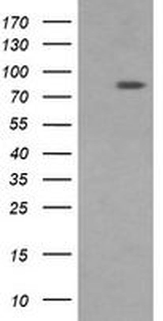 DNM1L Antibody in Western Blot (WB)