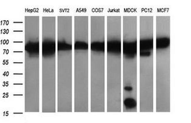 DNM1L Antibody in Western Blot (WB)