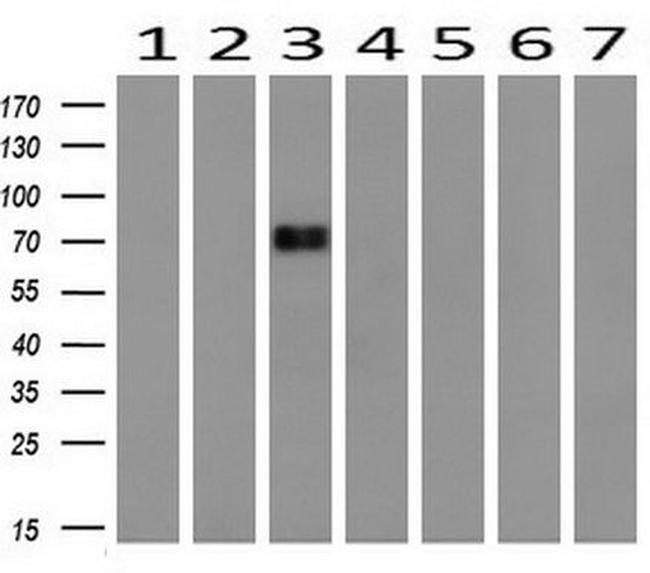 DNM1L Antibody in Western Blot (WB)