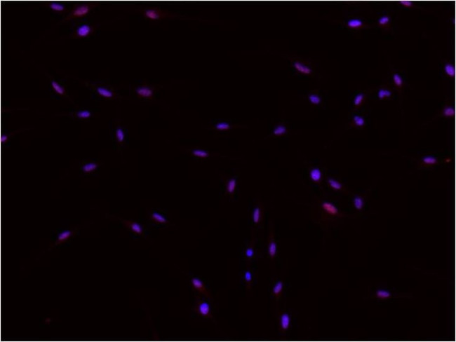 DNMT1 Antibody in Immunocytochemistry (ICC/IF)