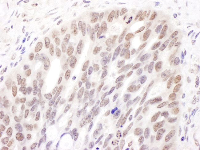 DNMT3A Antibody in Immunohistochemistry (IHC)