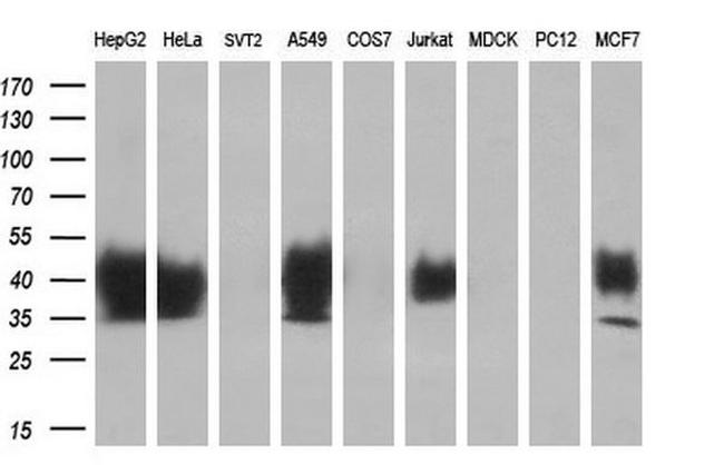 DNTTIP1 Antibody in Western Blot (WB)