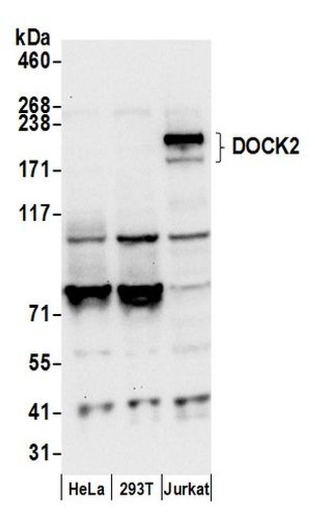 DOCK2 Antibody in Western Blot (WB)