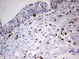 DOCK2 Antibody in Immunohistochemistry (Paraffin) (IHC (P))