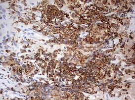 DOCK2 Antibody in Immunohistochemistry (Paraffin) (IHC (P))