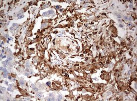 DOCK2 Antibody in Immunohistochemistry (Paraffin) (IHC (P))