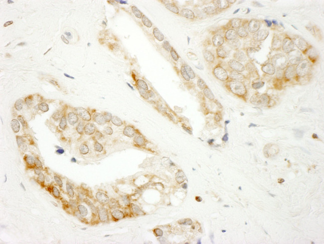 DOCK4 Antibody in Immunohistochemistry (IHC)