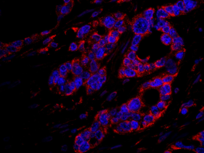 DOCK4 Antibody in Immunohistochemistry (IHC)