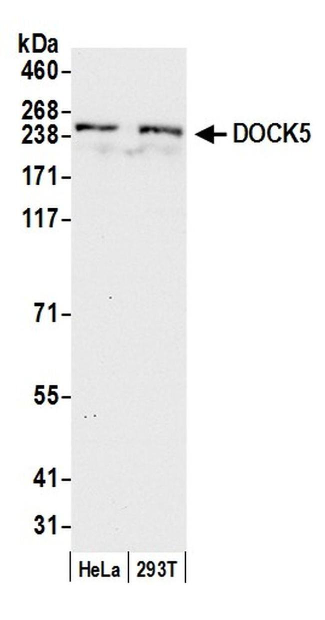DOCK5 Antibody in Western Blot (WB)