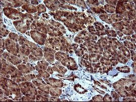 DOCK8 Antibody in Immunohistochemistry (Paraffin) (IHC (P))