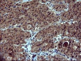 DOCK8 Antibody in Immunohistochemistry (Paraffin) (IHC (P))