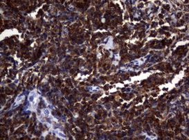 DOCK8 Antibody in Immunohistochemistry (Paraffin) (IHC (P))