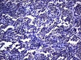 DOCK8 Antibody in Immunohistochemistry (Paraffin) (IHC (P))