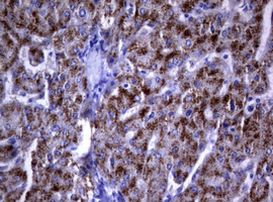 DOCK8 Antibody in Immunohistochemistry (Paraffin) (IHC (P))