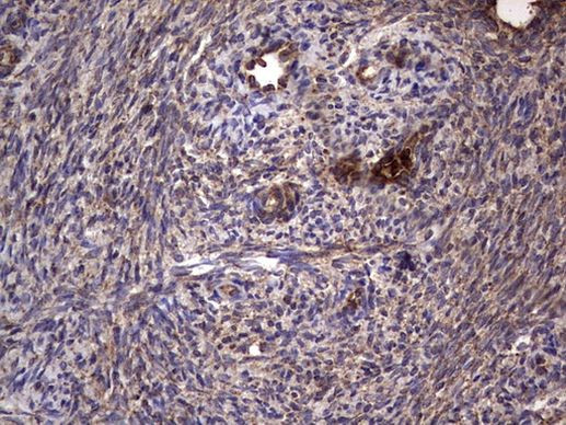 DOCK8 Antibody in Immunohistochemistry (Paraffin) (IHC (P))