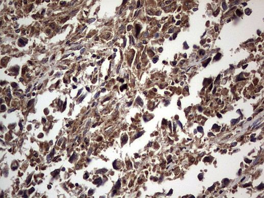 DOCK8 Antibody in Immunohistochemistry (Paraffin) (IHC (P))