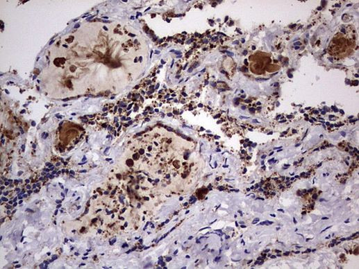 DOCK8 Antibody in Immunohistochemistry (Paraffin) (IHC (P))