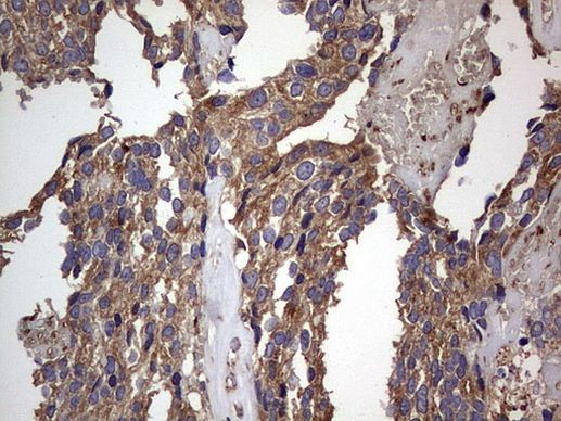 DOCK8 Antibody in Immunohistochemistry (Paraffin) (IHC (P))