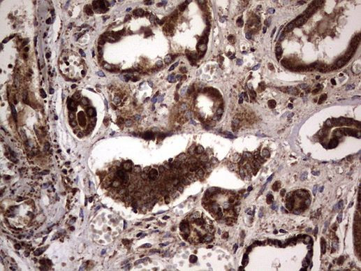 DOCK8 Antibody in Immunohistochemistry (Paraffin) (IHC (P))