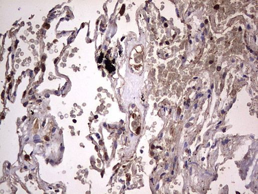 DOCK8 Antibody in Immunohistochemistry (Paraffin) (IHC (P))