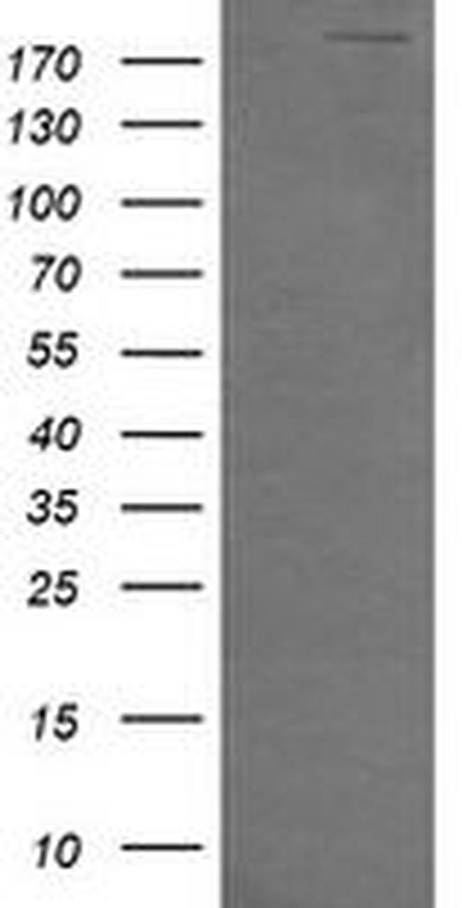 DOCK8 Antibody in Western Blot (WB)