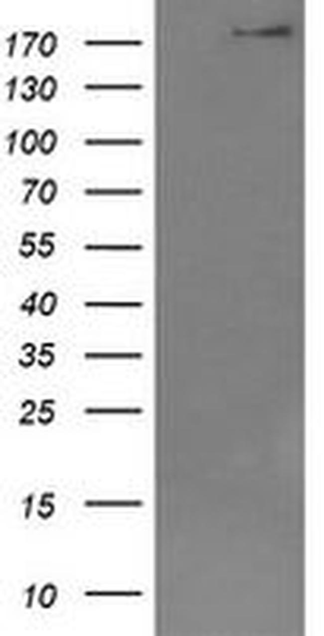 DOCK8 Antibody in Western Blot (WB)