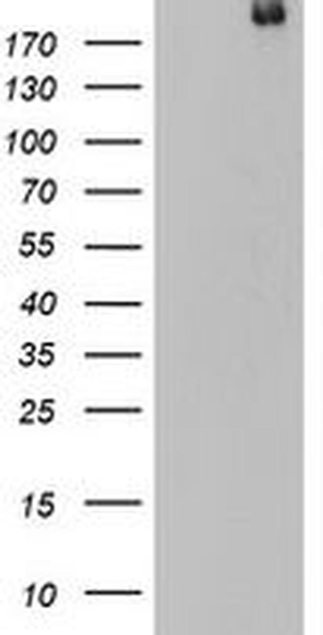 DOCK8 Antibody in Western Blot (WB)