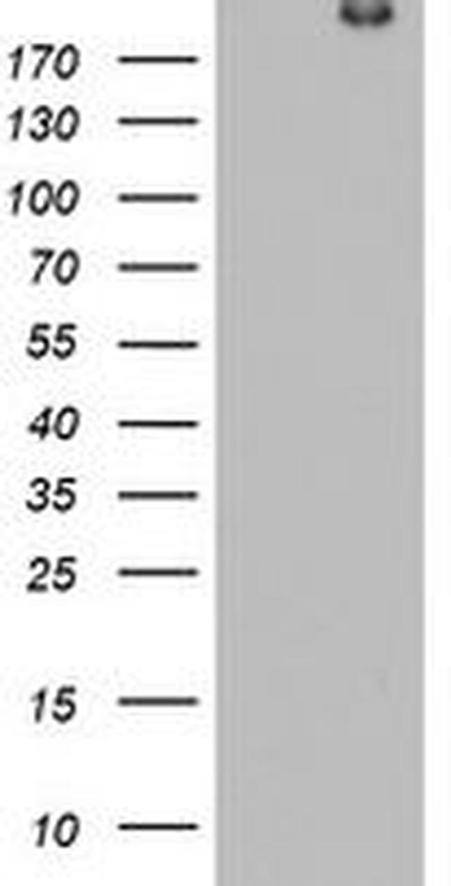 DOCK8 Antibody in Western Blot (WB)