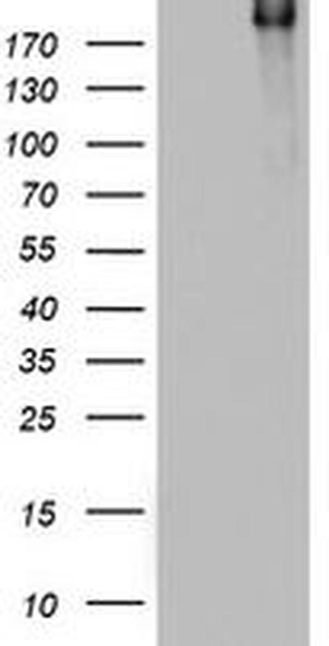 DOCK8 Antibody in Western Blot (WB)