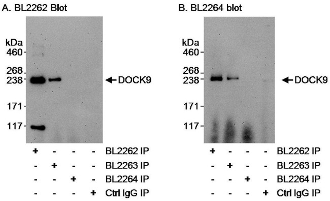 DOCK9 Antibody in Immunoprecipitation (IP)