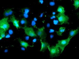 DOK7 Antibody in Immunocytochemistry (ICC/IF)