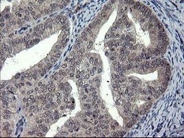 DOK7 Antibody in Immunohistochemistry (Paraffin) (IHC (P))