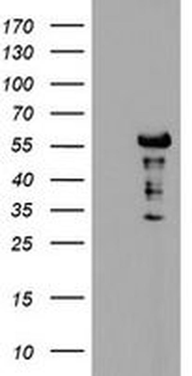 DOK7 Antibody in Western Blot (WB)