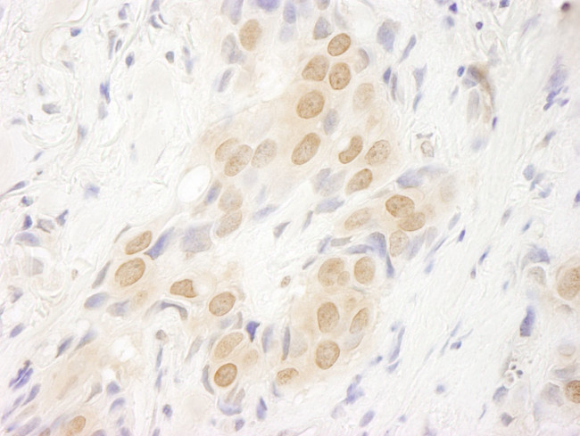 DOT1L Antibody in Immunohistochemistry (IHC)