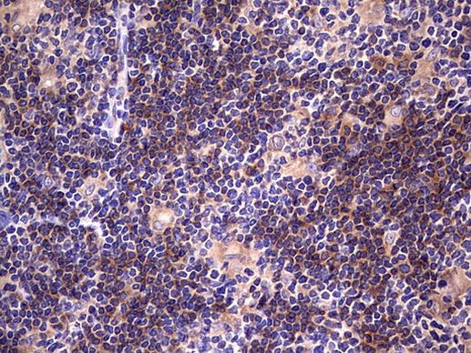 DOT1L Antibody in Immunohistochemistry (Paraffin) (IHC (P))