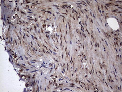 DOT1L Antibody in Immunohistochemistry (Paraffin) (IHC (P))