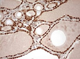 DOT1L Antibody in Immunohistochemistry (Paraffin) (IHC (P))