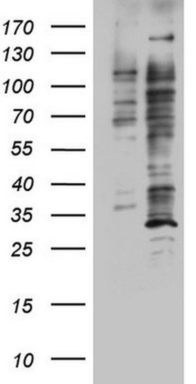 DOT1L Antibody in Western Blot (WB)