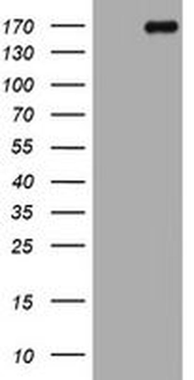 DOT1L Antibody in Western Blot (WB)