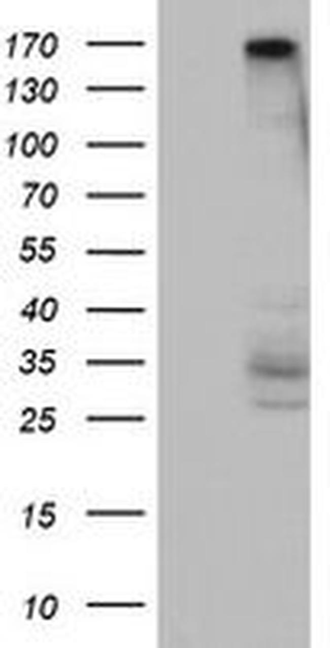 DOT1L Antibody in Western Blot (WB)