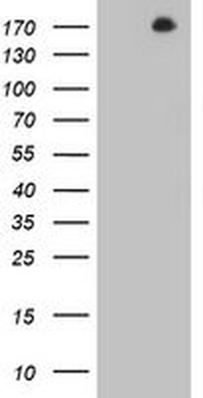 DOT1L Antibody in Western Blot (WB)