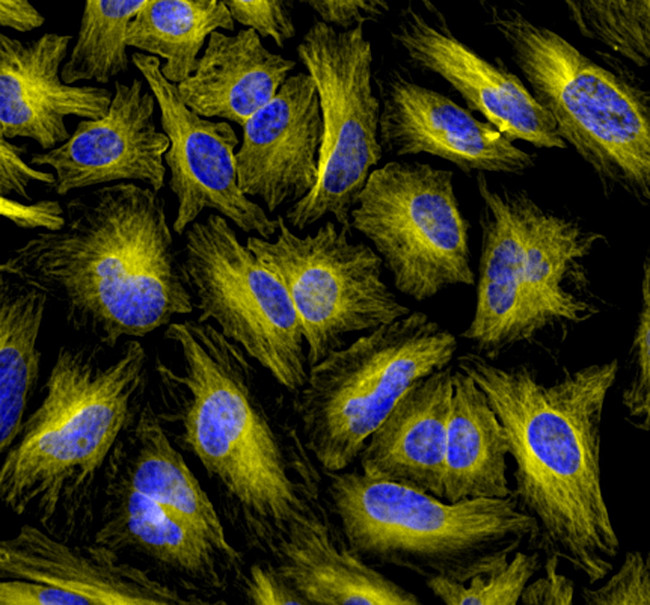 Rat IgG (H+L) Highly Cross-Adsorbed Secondary Antibody in Immunocytochemistry (ICC/IF)