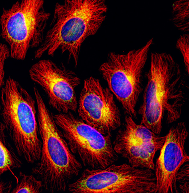 Rat IgG (H+L) Highly Cross-Adsorbed Secondary Antibody in Immunocytochemistry (ICC/IF)