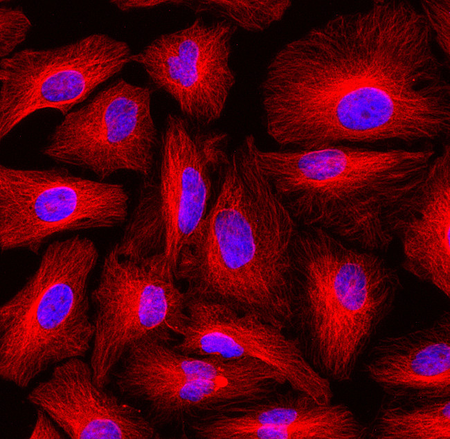 Rat IgG (H+L) Highly Cross-Adsorbed Secondary Antibody in Immunocytochemistry (ICC/IF)