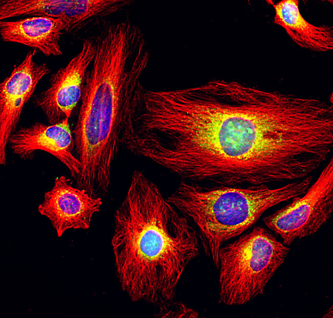 Rat IgG (H+L) Highly Cross-Adsorbed Secondary Antibody in Immunocytochemistry (ICC/IF)